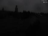 03 : 20