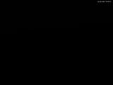 00 : 20