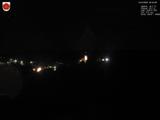 00 : 00